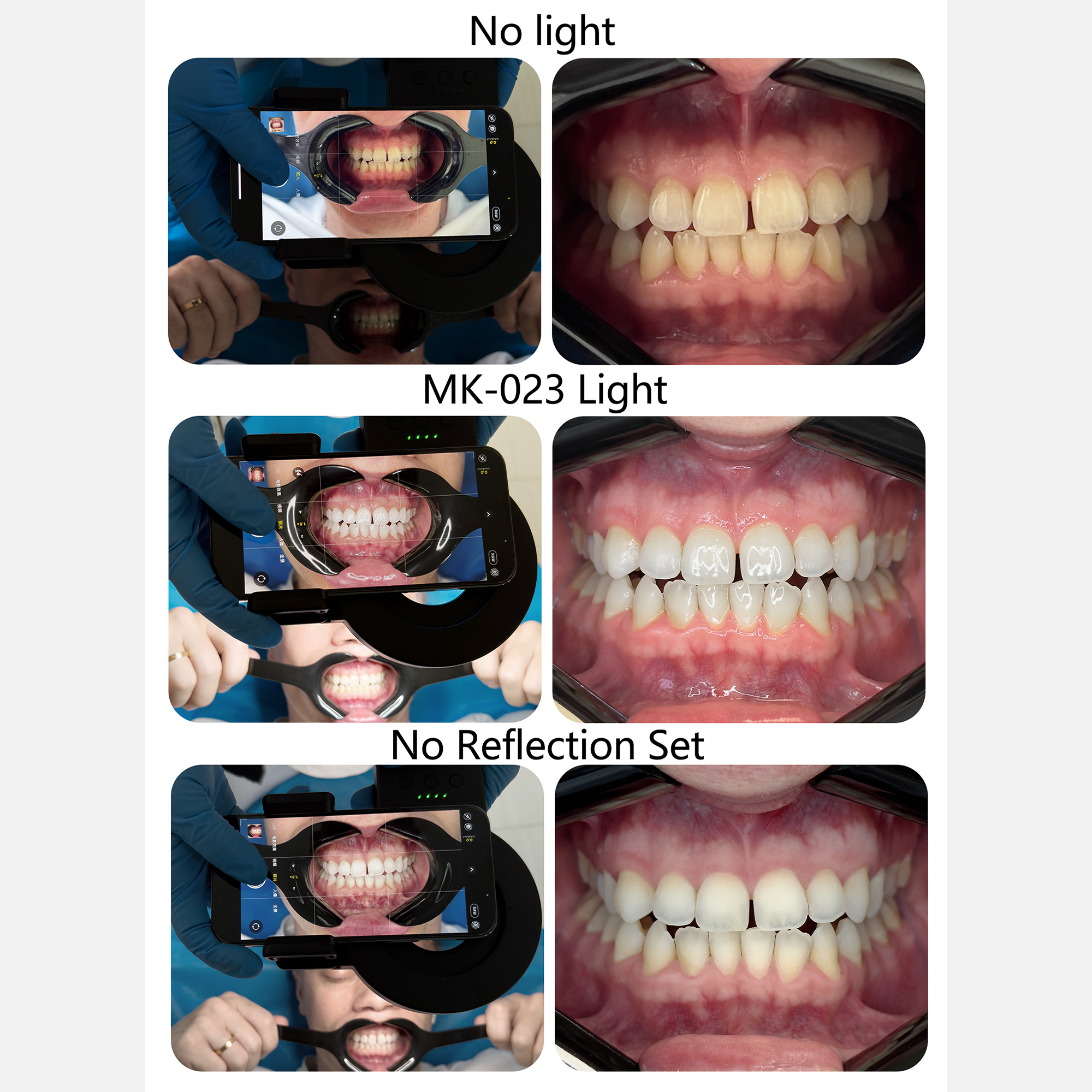 HERA MK-23 Intraoral Dental Ph – обзор и цена Photography Lighting Lamp